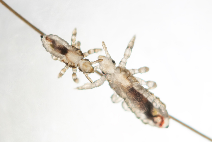 Real photo of head lice. Adult head louse with nymfa head louse on human hair above white background. Pediculus capitis